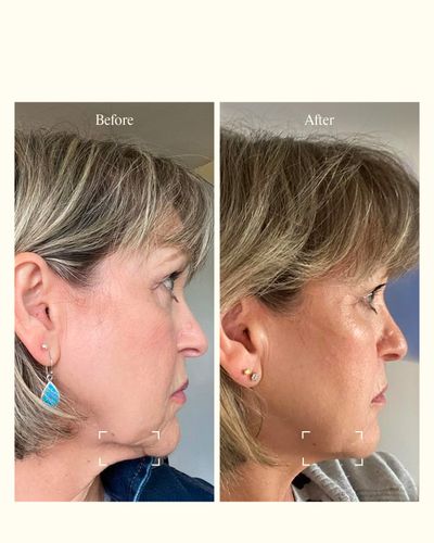 B&A