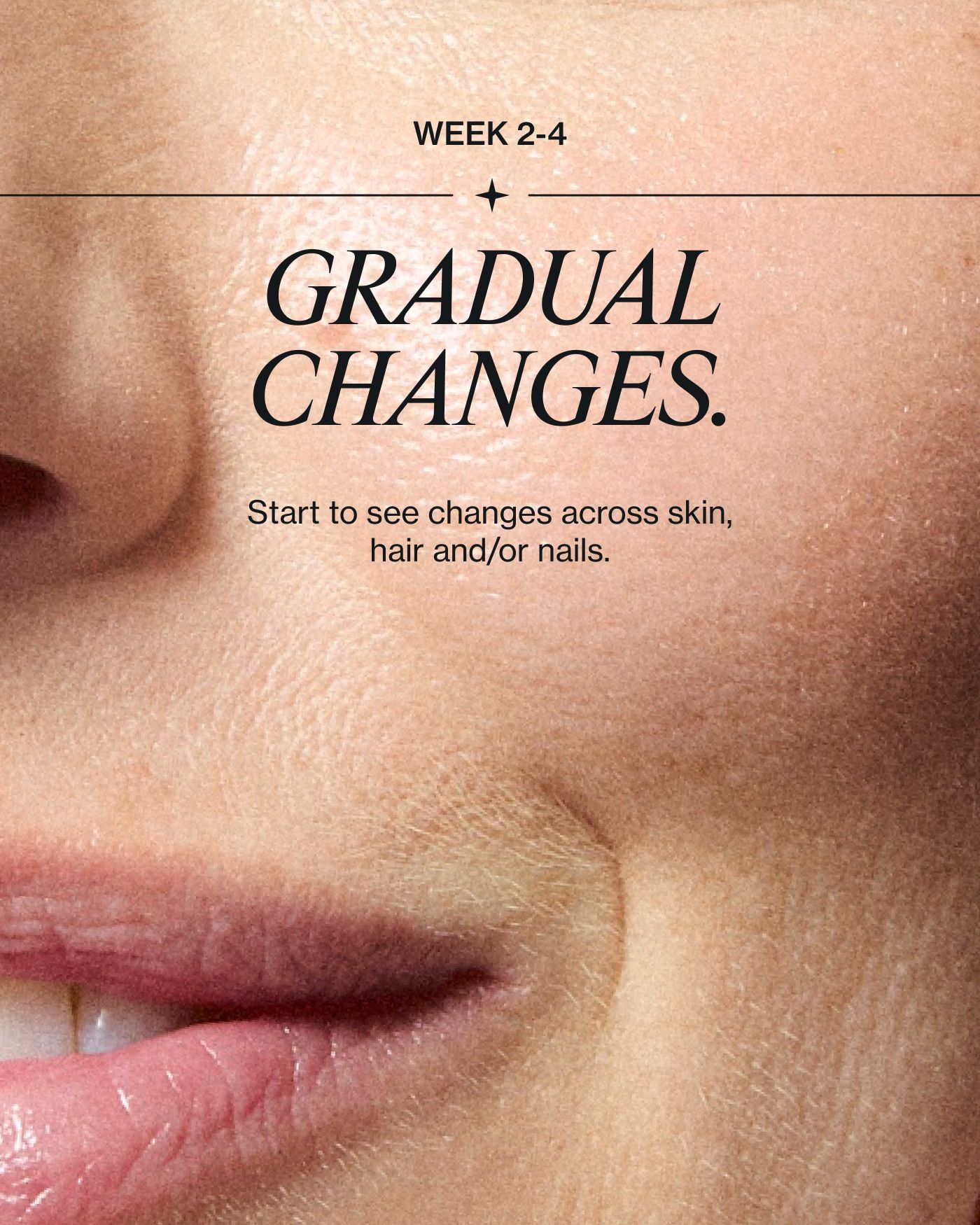 gradual