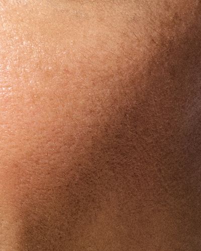 skin