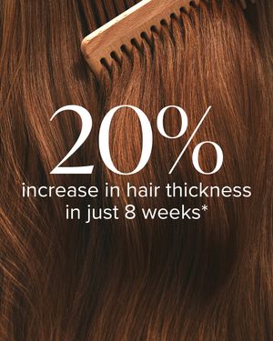 20%