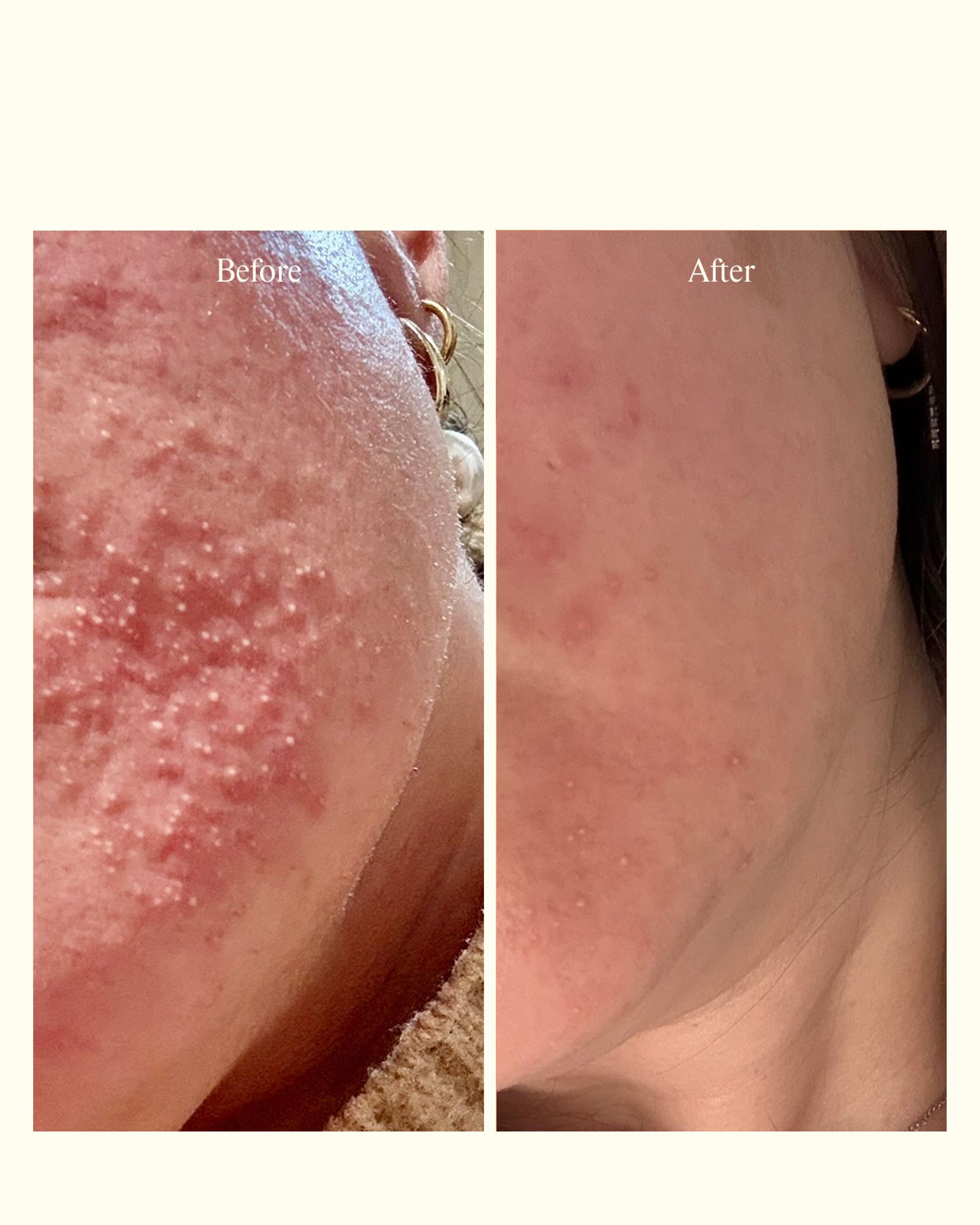 before & after