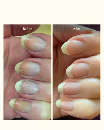 B&A