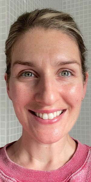 Claire after collagen photo