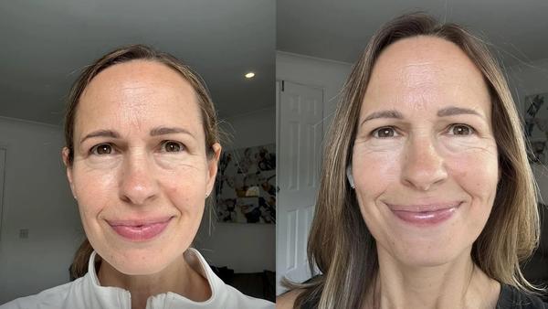 De belles réussites avec le collagène