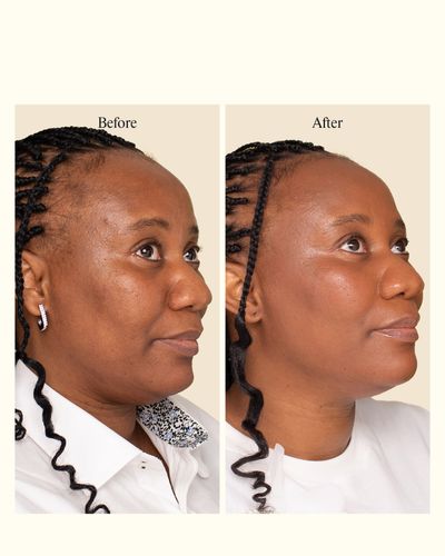 B&A