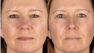 Before and After Testimonial 1