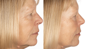 Before and After Testimonial 2