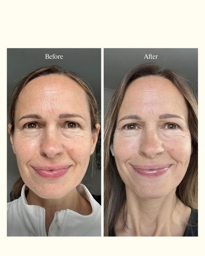 B&A