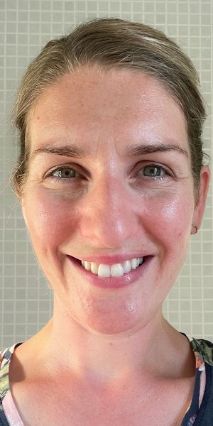 Claire before collagen photo