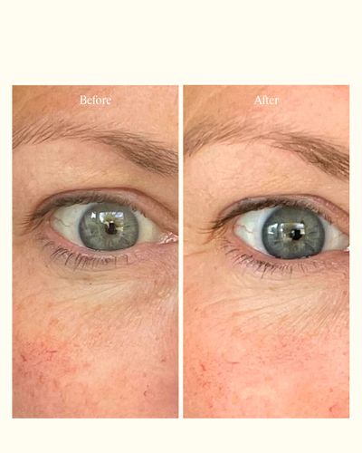 B&A