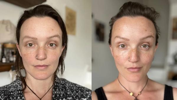 Before and After testimonial